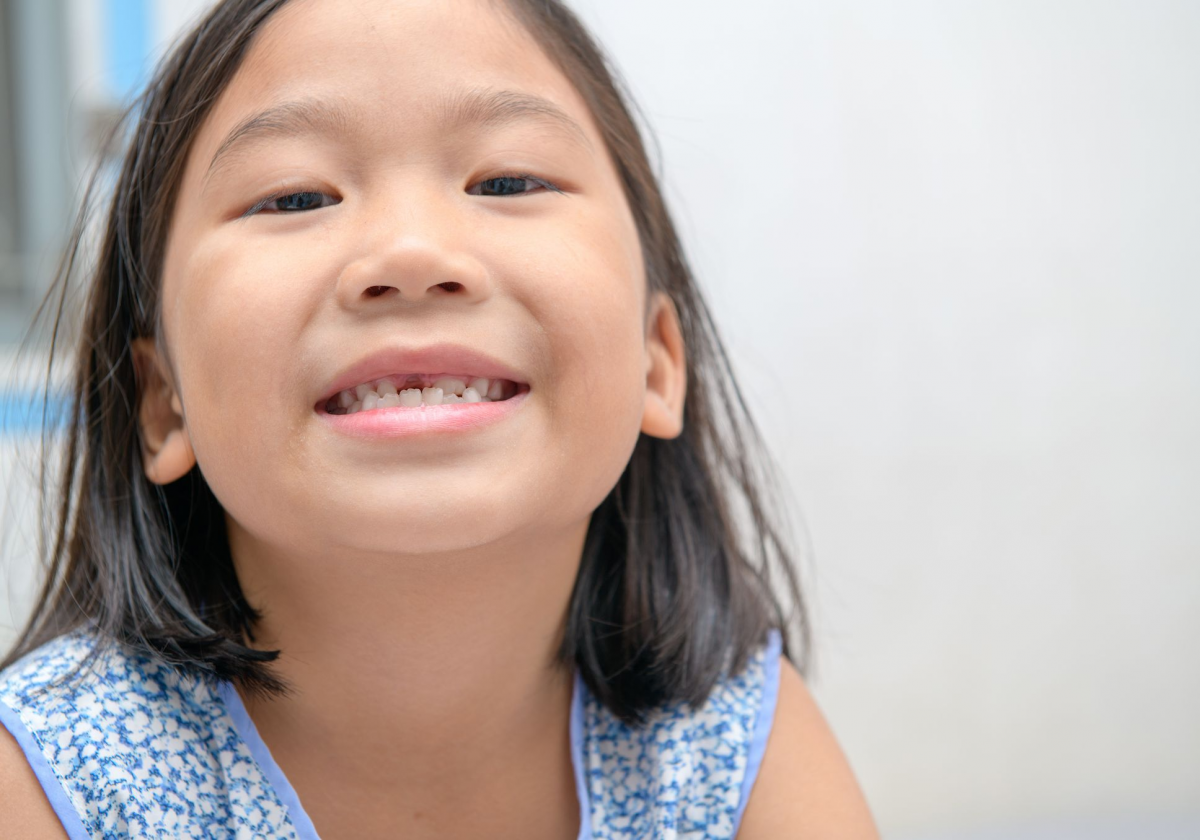 Seorang anak kecil sedang menunjukkan gigi susunya yang patah